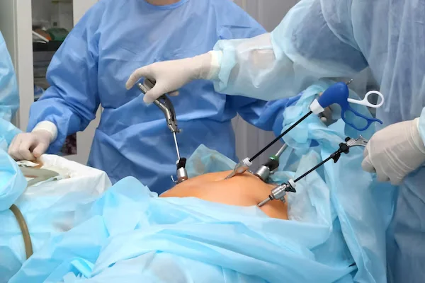 Laparoscopic Surgery